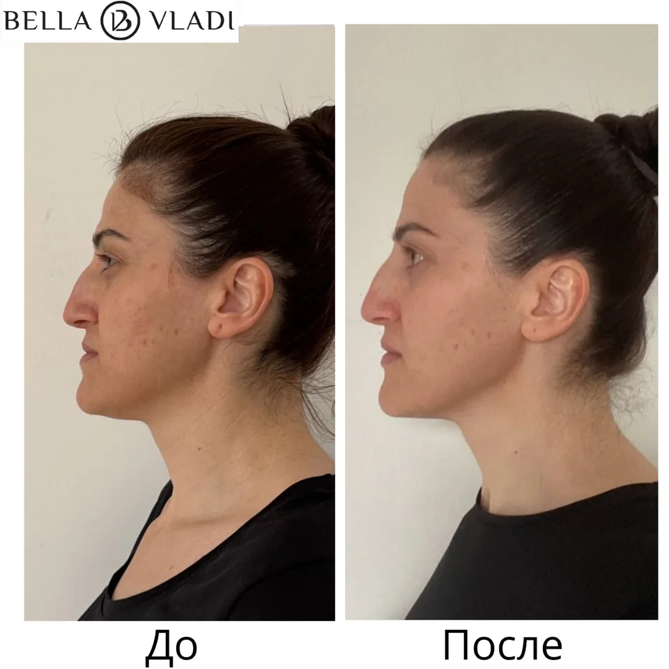 Сравнение профиля участницы до и после занятий